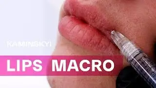 УВЕЛИЧЕНИЕ ГУБ. МАКРОСЪЁМКА | LIPS AUGMENTATION. MACRO★ EDGAR KAMINSKYI