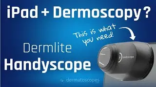 iPads & Dermoscopy? Think Handyscope!