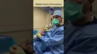 Ethnic-Middle Eastern Rhinoplasty! | Intra Operation! I Septoplasty!