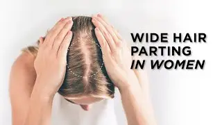 Get Rid Of your Wide Part-Line with Hair Building Fibers