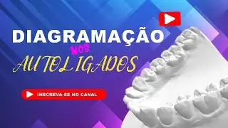 Como fazer a diagramação dos arcos para a finalização do tratamento na Mecânica Autoligada.