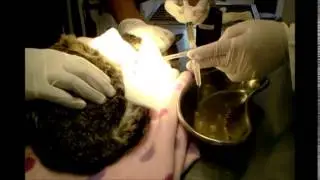 Toracocentese em felino com efusão pleural .
