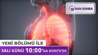 10'danSonra Salı 10:00'da Kontv'de