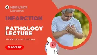 Infarction Pathology Lecture MBBS BDS Second year