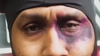 PISTOL GOT HIT IN THE FACE WITH A HOOKAH🤣🤣🤣 