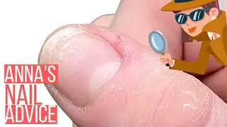 HORRIBLE CUTICLES?This info will change everything! 🤯[ANNA’S NAIL ADVICE]