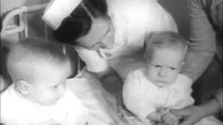 Siamese Twins are Parted & Live, Holland 1954