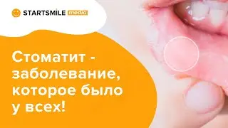 Стоматит - симптомы, лечение и возможные осложнения