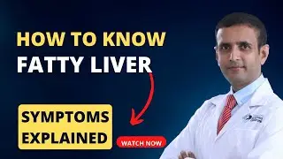 How to Know if You Have a Fatty Liver? #fattyliver #liverdisease #weightloss