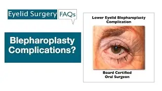 What are the Possible  Complications of Blepharoplasty (Eyelid Surgery)?