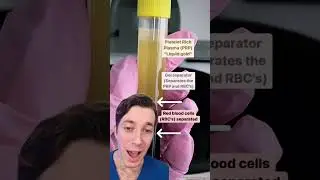 Benefits of PRP for Your Hair Loss 