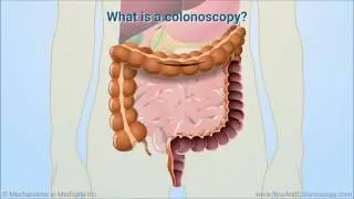 Patient Case Scenario- Colonoscopy