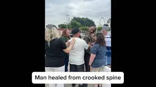 Man healed with crooked spine.