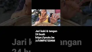 Keluarga dg jari 24 buah.    https://youtu.be/aTdWF672DNM