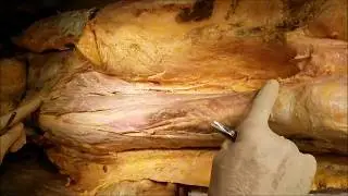 Thigh Anterior Femoral Triangle Adductor Canal Surgical Dissection With Clinical Aspects Sanjoy Sany