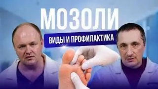 МОЗОЛИ: какие бывают и как избавиться от них навсегда?