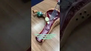 Keputihan Cair Mirip Pipis, Bahaya?