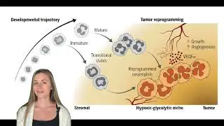 Rogue immune cells promote cancer progression (Ng et al, Science 2024)