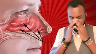 Eustachian Tube Dysfunction: Unclog your ear instantly