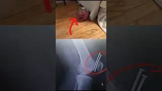 это самые удачливые люди в мире #реддит #adme #апвоут #reddit #удача