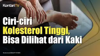 Ciri-ciri Kolesterol Tinggi, Bisa Dilihat dari Kaki | Kontan News