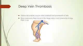 DVT NAC OSCE course https://www.mededucanada.com/nac-osce-course-mccqe2-capbc-cex