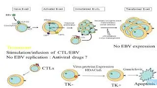 Virus et Lymphomes partie 12 (fin): EBV suite