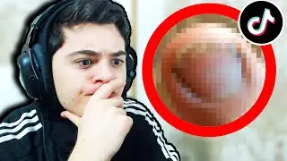 ფრჩხილის ASMR?