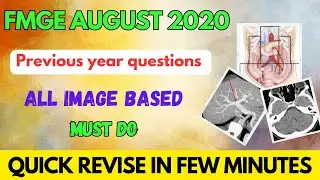 FMGE AUGUST 2020 PREVIOUS YEAR image based questions revisions #fmge #neetpg #mbbs #next #fmge2023