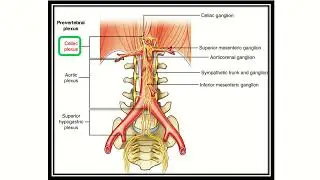 Coeliac plexus location MRCS question solve (CRACK MRCS)