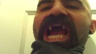 hairy fangbangers
