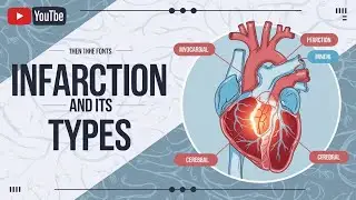 Infraction & its types (White & Red) || General Pathology || Past Papers || Robbins || Hemodynamics