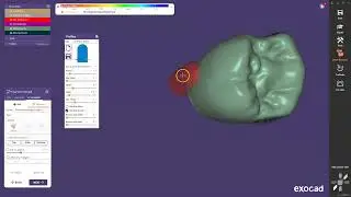 How to make a implant screw hole manually in exocad
