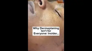 Why Dermaplaning Isn't for Everyone!