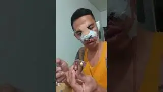 My Rhinoplasty Journey| Part 2