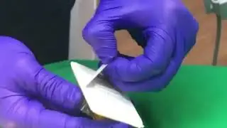 Имплантация зубов.