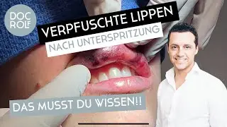 LIPPEN AUFSPRITZEN SCHIEF GEGANGEN – Dr. Rolf Bartsch