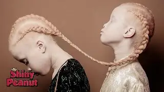 Anak-Anak Ini Sulit Dipercaya Keberadaannya