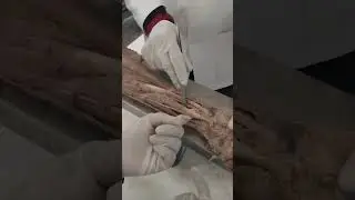 Anatomy Dissection class with real cadaver | Muscles of forearm #mbbs #mbbsstudent#mbbslife #shorts