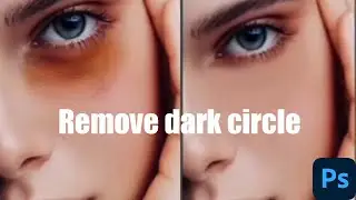 How To Remove Dark Circle In Photoshop.