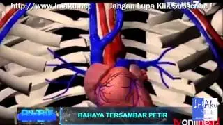 Proses Terjadinya Petir On The Spot Terbaru Trans 7
