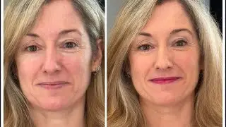 MAQUILLAJE PARA ROSÁCEA. El antes y después de Emma en formato especial. ANA APARICHI
