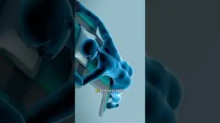 How Surgeons Remove a Hemorrhoid Explained