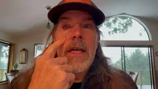 Thyroid eye disease update post Strabismus surgery