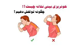 خونریزی بینی نشانه چیست و  چگونه آنرا متوقف کنیم ؟