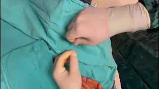 anjiyo da Sheath nasıl takılır