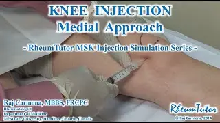 KNEE ASPIRATION / INJECTON - MEDIAL APPROACH: Step-By-Step Teaching Simulation