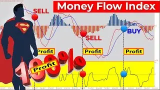 🔴 Forex & Stocks 