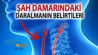 Şah Damarı Daralması Belirtileri