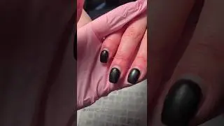 Поднятие клюющих ногтей #маникюр #залипалово #nailart #ногти #ремонтногтей